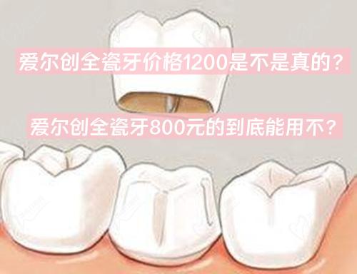 愛(ài)爾創(chuàng)全瓷牙價(jià)格1200是不是真的