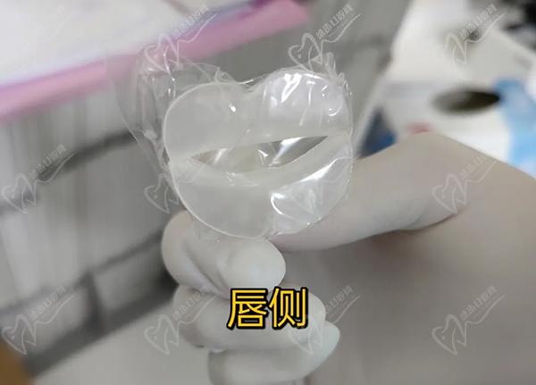 嘟嘟嘴矯正器