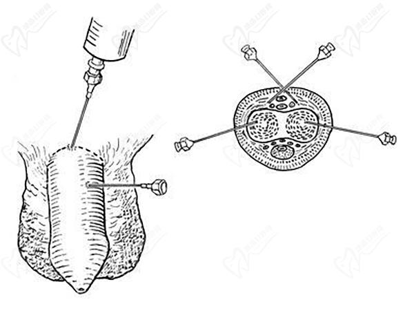 重慶星榮整形外科醫(yī)院男科手術(shù)優(yōu)勢(shì)