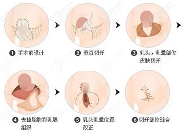 2024北京聯(lián)合麗格醫(yī)院微整注射收費標(biāo)準