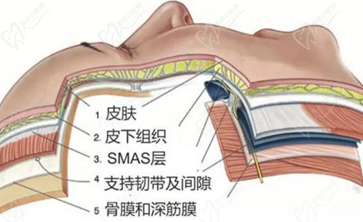 杜太超拉皮技術(shù)怎么樣