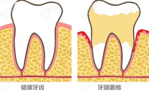 牙齒松動怎么辦