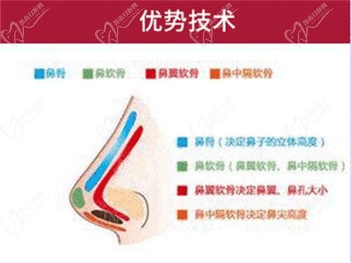 李競(jìng)醫(yī)生肋骨鼻綜合口碑不錯(cuò)