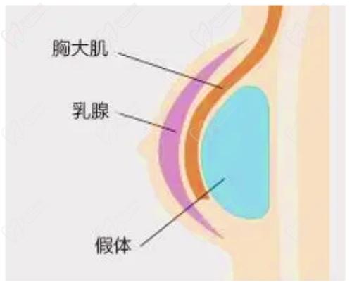 四川米蘭柏羽醫(yī)療美容隆胸技術高超