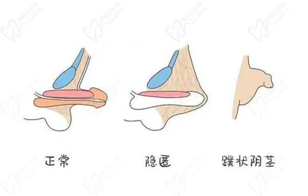 李世榮醫(yī)生做男科手術(shù)怎么樣