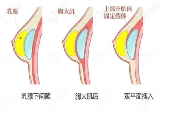 殷初陽醫(yī)生個人簡介