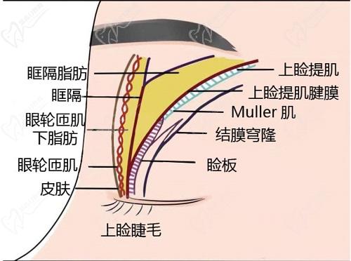 師麗麗雙眼皮修復(fù)技術(shù)