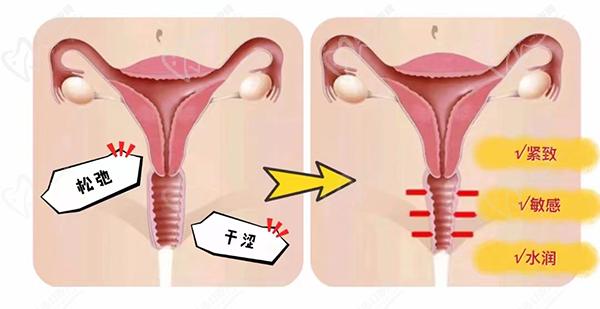 重慶做私密緊縮手術私立醫(yī)院排行