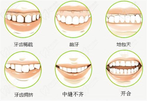 可麗兒隱形矯正多少錢一副2025長效機製？