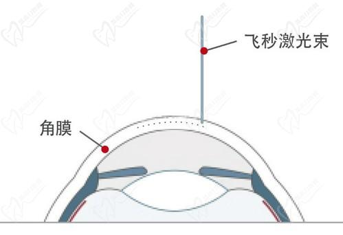 王曉瑛醫(yī)生在哪里出診？上海普瑞紮實、上海和平等眼科醫(yī)院可預(yù)約