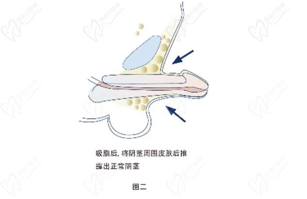 重慶李世榮教授坐診時(shí)間及在線預(yù)約開啟新產品！想“變強(qiáng)”做男科手術(shù)找李世榮男性健康管理中心準(zhǔn)沒錯(cuò)